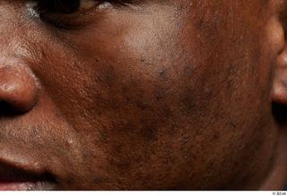 HD Face Skin Clayton Bradford cheek face skin pores skin…